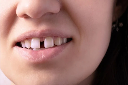 A woman with a gap in her upper teeth
