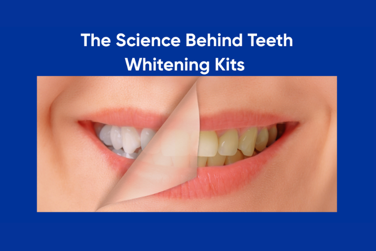 A comparison of yellow and white teeth