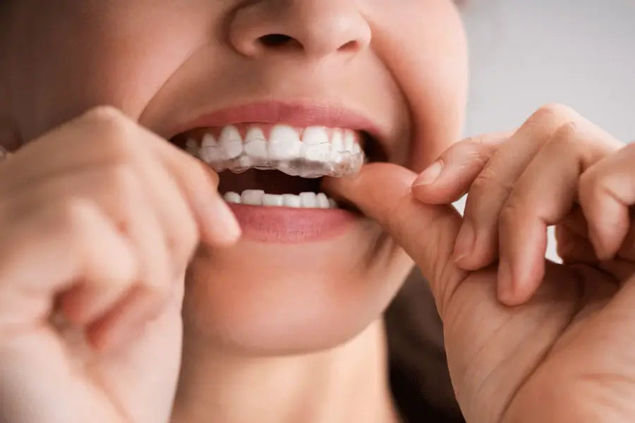 The Convenience and Comfort of Invisible Aligners