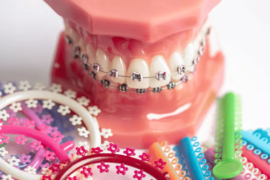 Teeth straightening options