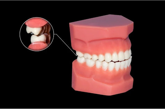 A 3D model showing Class 1 bite