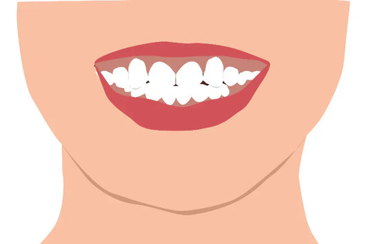 An illustration of a woman smiling with the snaggletooth