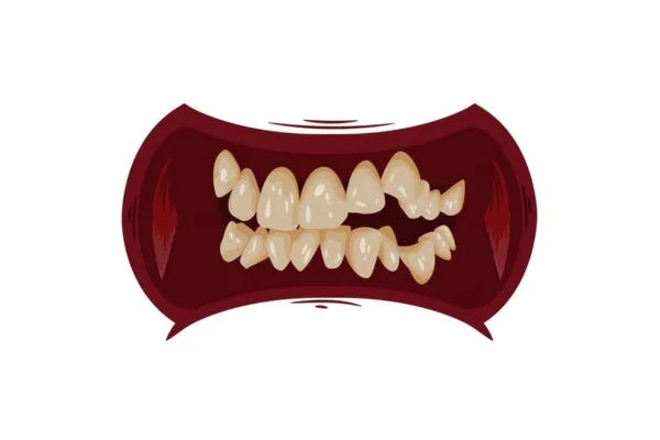 Flawed Yet Fabulous – Celebrities With Crooked Teeth