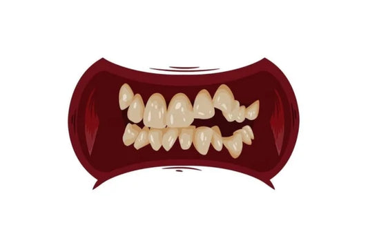 Flawed Yet Fabulous – Celebrities With Crooked Teeth