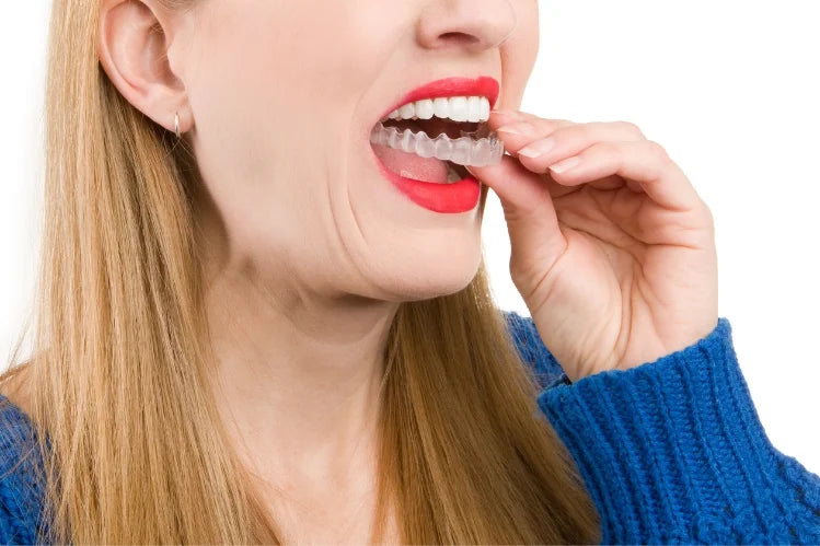 An image of a woman wearing putting on multifunctional braces to straighten her teeth