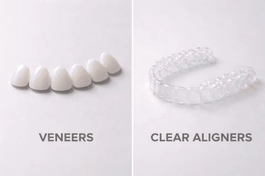  Clear aligners with veneers