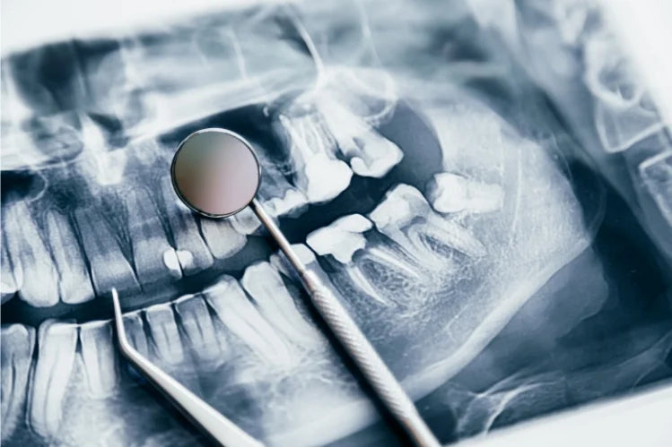 Close-up view of a dental X-ray showing teeth and jaw structure