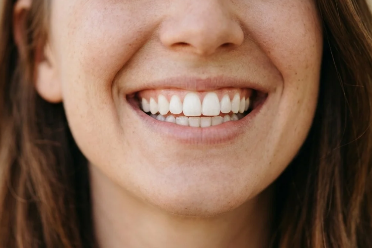 Close-up of a woman with freckles smiling to show natural white teeth
