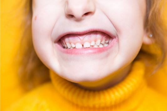 A close-up image of a child's overbite