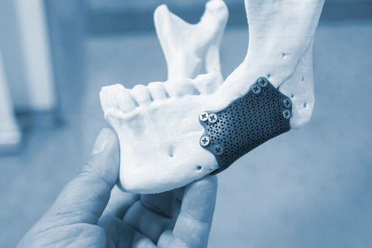 A person holding a prototype lower jaw