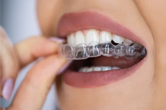 A girl trying to wear a clear aligner