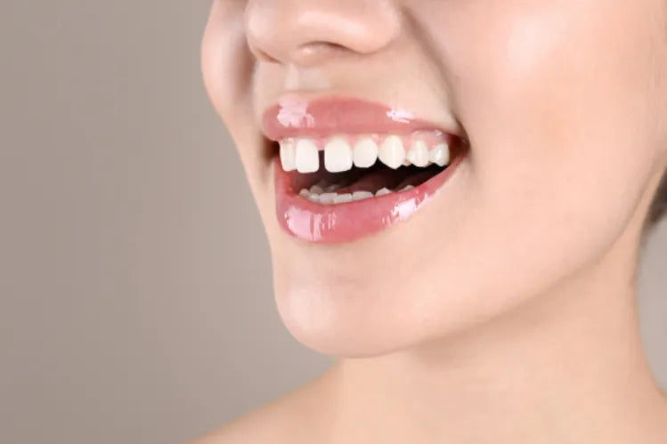 : A woman with a minor teeth gap.