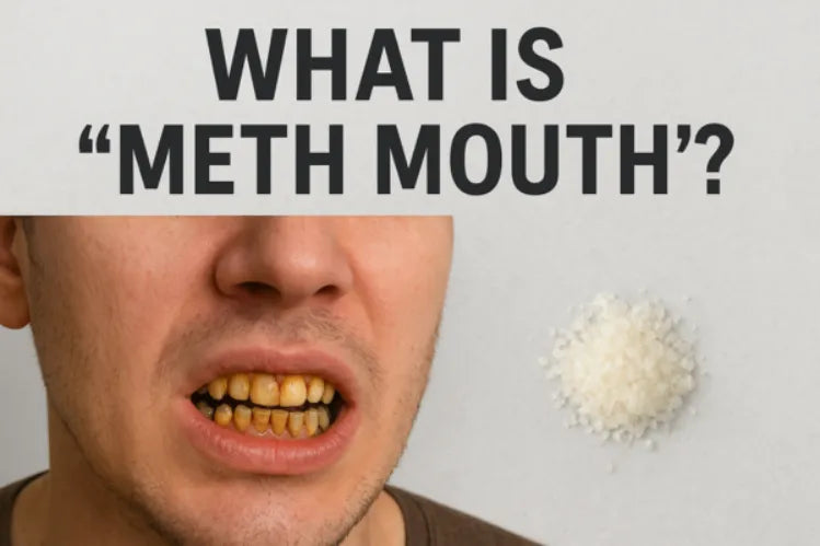 A guy with yellow bad teeth and meth on the side 