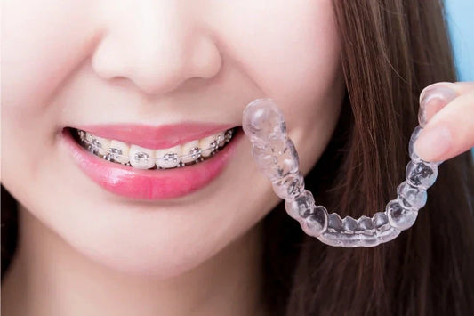 Clear Braces Near Me: How to Find the Right Provider