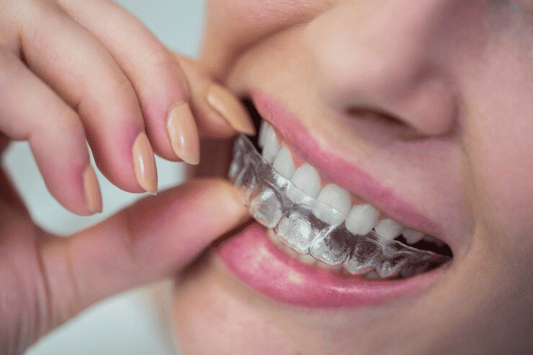 Clear Aligners for teeth straightening
