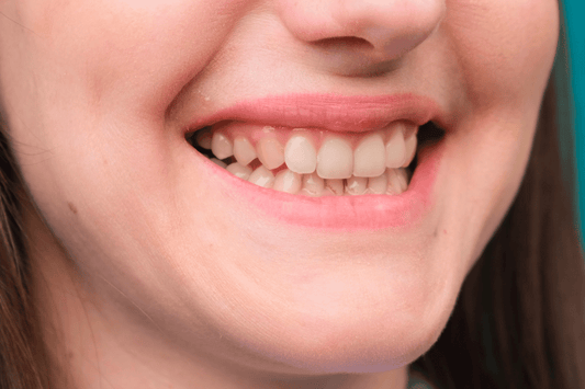 Clear Aligners & Enamel Protection During Orthodontic Treatment