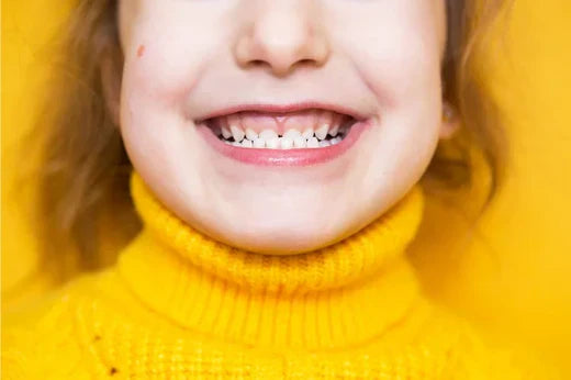 girl_showing_her_overbite