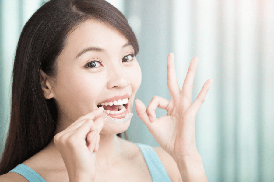 clear aligners